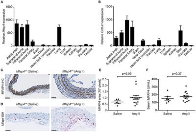 MFAP4 Deficiency Attenuates Angiotensin II-Induced Abdominal Aortic Aneurysm Formation Through Regulation of Macrophage Infiltration and Activity